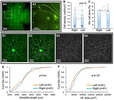 The Susceptibility of Retinal Ganglion Cells to Glutamatergic Excitotoxicity Is Type-Specific